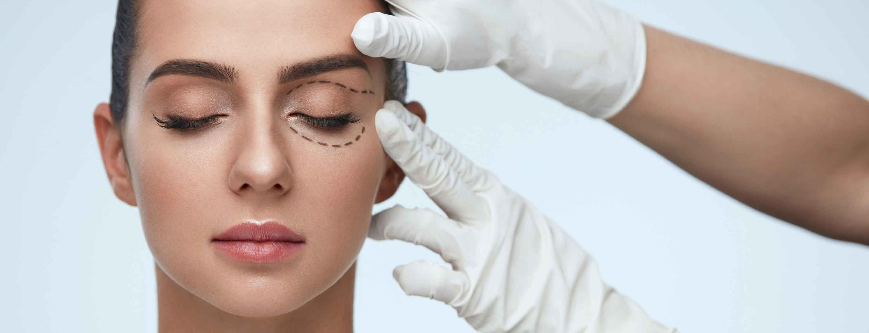 Harmonização Facial - Dra. Aline Guzzi: Blefaroplastia Sem Cortes